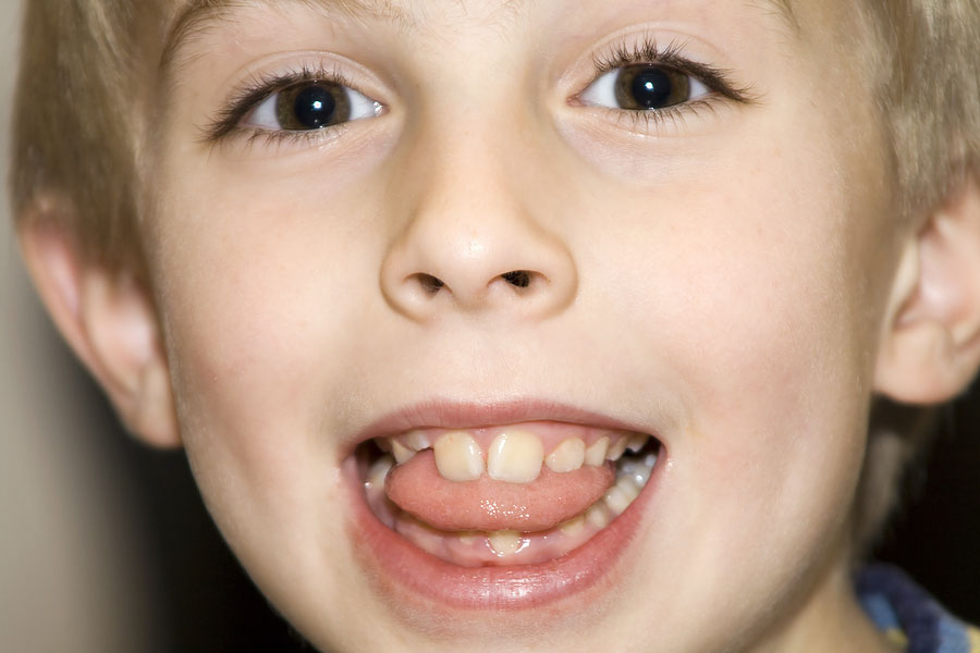 dziecko dentysta